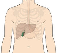 Robotic Cholecystectomy for Gallbladder Disease at The Jackson Clinic